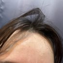 6325 | [신림 점핑운동다이어트] 비상🚨다들 여름 준비 하시나요? 신림다이어트 유체이탈 하고 온 후기