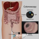 조양수지 이미지