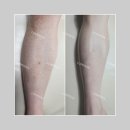 롬프란 스킨앤바디 이미지