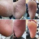 회정로 | 양주 옥정 발각질 효과 좋았어요 굿네일 만족 후기