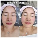 계룡초등학교 | 거제에스테틱 뷰티앤힐링 피부볼륨 살린 후기