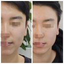 강서 마곡피부관리 더작 마곡점 윤곽관리 후기