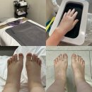 (주)아름 | 아름제일 산후조리원 마사지 | 출산 후 붓기 비포 에프터