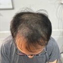 돕스칼프 이미지