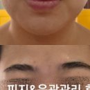 윤피부샵 네이버블로그