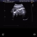 삼성미래여성병원 이미지