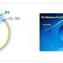 밝은눈안과 안내렌즈삽입술(ICL) vs 일반라식 이미지