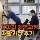 광양시건강증진센터 | 수원재활센터 X다리교정과 무릎관절염 재활운동후기