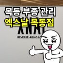 목동2차아크로텔 뒤 | 엑스날 목동점 레아쥬 테라피로 부종 붓기 박살 내고 온 후기