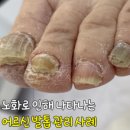 부모님, 시부모님 추석선물 추천! 만족도 높은 발관리 - 세곡 레푸스