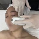 미브이 | 서울 동대문 장안동 에스테틱 가꾸다미 | 브이라인 관리 하이푸 3000샷 찐만족 후기