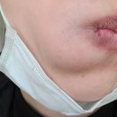 봄날애의원 | 장안동 피부과 봄날애의원 이곳만 찾게되는이유