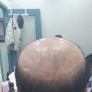 백가발 이미지