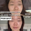 [구미상모동피부관리] 미쁘다뷰티 | 데콜테맛사지포함 플라즈마멀티 체험기💖