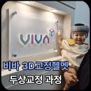 담아보기 | [비바3d 두상교정 헬멧 수장후기]-교정과정 담아보기(추천인코드)