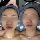 상동약국 | 상동역 피부관리 더예쁠예정 부천상동역점