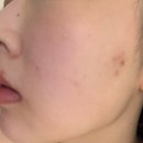 마르지아힐링스파 | 천호피부관리 [달스파 산전 산후 웨딩관리 전문] 하프문 페이셜 홍조 장벽케어 받고온 찐만족후기