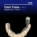 Plus 치과기공소 이미지