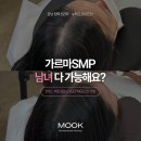 OK 365금오점 | 강남 가르마 SMP 후기ㅣ남녀 탈모 이렇게 커버했어요