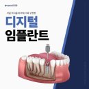 함양치과기공소 | 비용 대비 효과를 극대화 한 함양치과 디지털 임플란트
