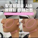 [공지] 대구리프팅 실패 없는 볼꺼짐 리프팅, 아미뷰티센터 온쎄라 관리