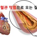 모세혈관의 충격적인 이야기 이미지