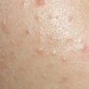 하늘토엠디한의원 이미지