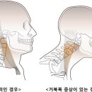 썸머핏(SUMMERFIT) 이미지