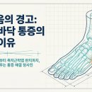 서울에이스마취통증의학과의원 | 발 아치 통증, 발바닥 당김이 지속되는 경우
