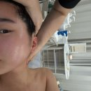 블루아네일 | 대전 윤곽관리 추천, 블루아에스테틱 얼굴축소관리 후기! (ft.겨드랑이 미백,데콜테 관리)