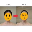 경주 민에스테틱 얼굴 비대칭 균형관리 후기 마사지 체형관리 잘하는 곳