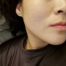 메이드 | 곡반정동피부관리 메이드뷰티 여드름관리 후기