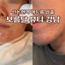 논현1-118 | 신논현역 여드름 압출 잘하는 보름달 뷰티 후기