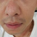 에이지에이 네이버블로그