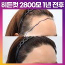 [20대 여자 M자 넓은 헤어라인 머리심기] 비절개 히든컷 모발이식 2800모 1년 후기 (모엠의원/헤어라인/전지훈원장) 이미지
