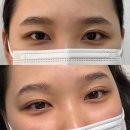 하나로솔한의원 | [부산] 속눈썹펌 광인의 눈매맞춤 퍼스널 펌 솔직 후기