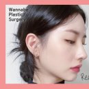 워너비성형외과의원 | 매부리코수술비용과 후기를 꼼꼼히 확인하면 #워너비성형외과