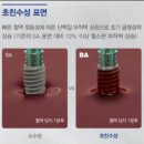 남중동-57 | 익산 임플란트 보험적용 당일식립 남중동 영등동 모현동 탑플란트