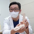 새움3로(서) | 구로구정형외과 무지외반증, 엄지발가락의 변형이 시작되었다면