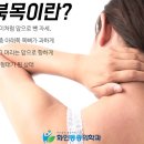 건대 정형외과 직장인의 고질병? 이미지