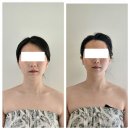 롯데마트 시계탑앞 | 배곧피부관리 3V테라피 흡족후기