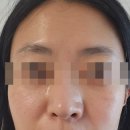 우비뇨기과의원 네이버블로그