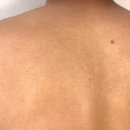 씨유어양퍼스트점 | 때문에 고민될 땐? 닭살케어까지 되는 바디크림 솔직후기 / 세라바인 바디크림 / 유어초이스 바이씨랩