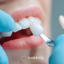 연세부부치과 네이버블로그