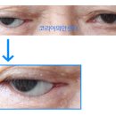 코리아의안센터 이미지