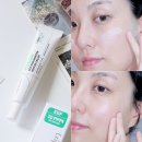 가온약국 | 약국화장품 지피덤 이지에프(EGF) 크림으로 데일리 피부 장벽 케어