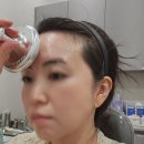 톤즈의원에서 경험한 엘러간 이마주름보톡스 솔직 후기