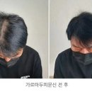 헤드라인유 이미지