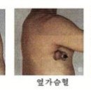 자연정혈요법 이미지