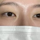 내추럴로 | 화곡속눈썹 맛집 내추럴포유! 짧고 얇은 속눈썹도 살아나는 펌 후기